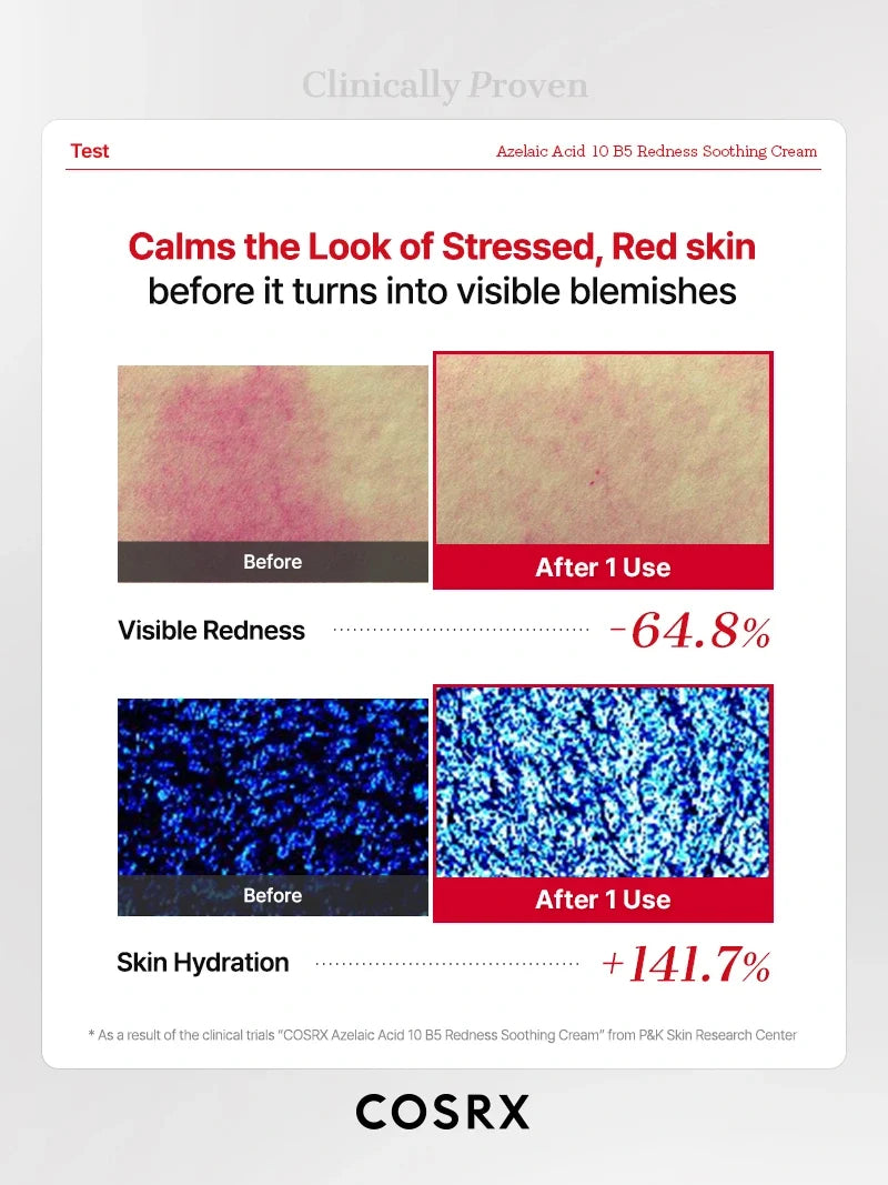 COSRX Azelaic Acid 10 B5 Redness Soothing Cream